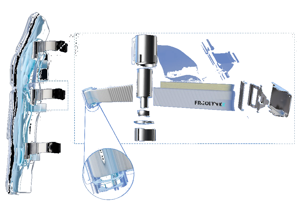Ergolynxx patented roller mechanism exploded view